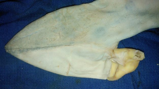 Fleshingmachines kept on a blue background